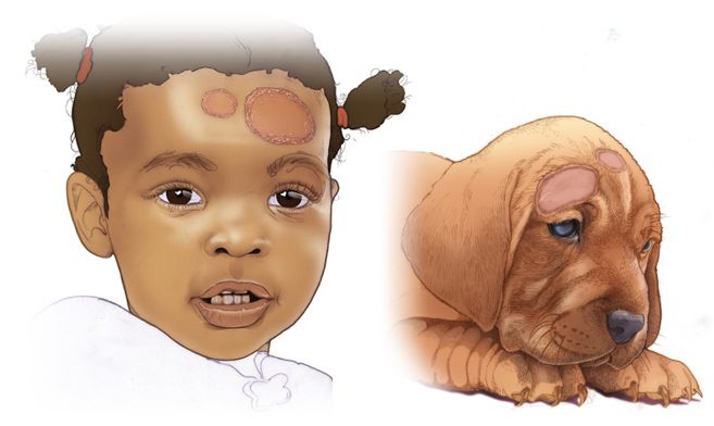 Ringworm on humans and pets