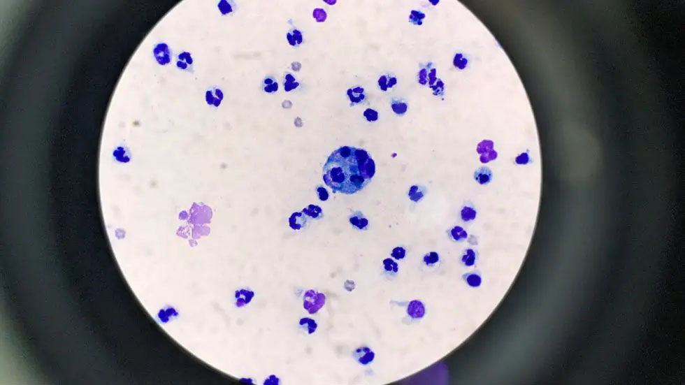 Microscope view